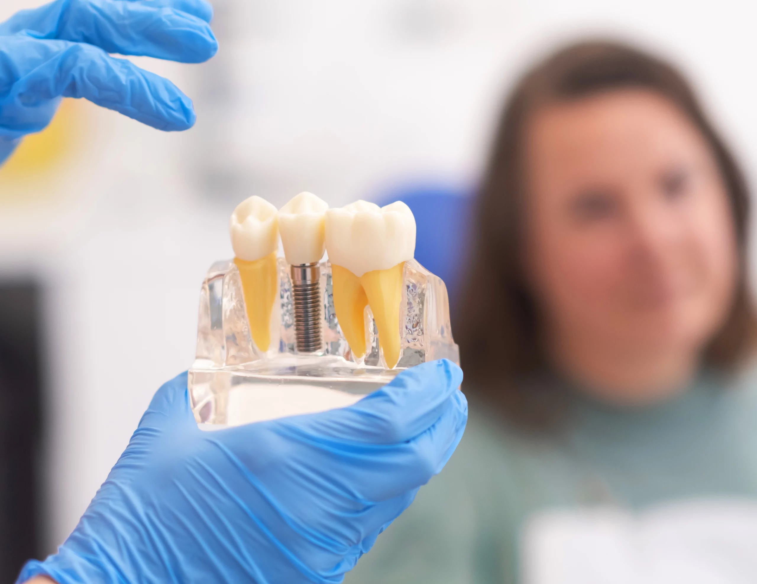 Dental implant placement procedure at Enhance Dental Dublin